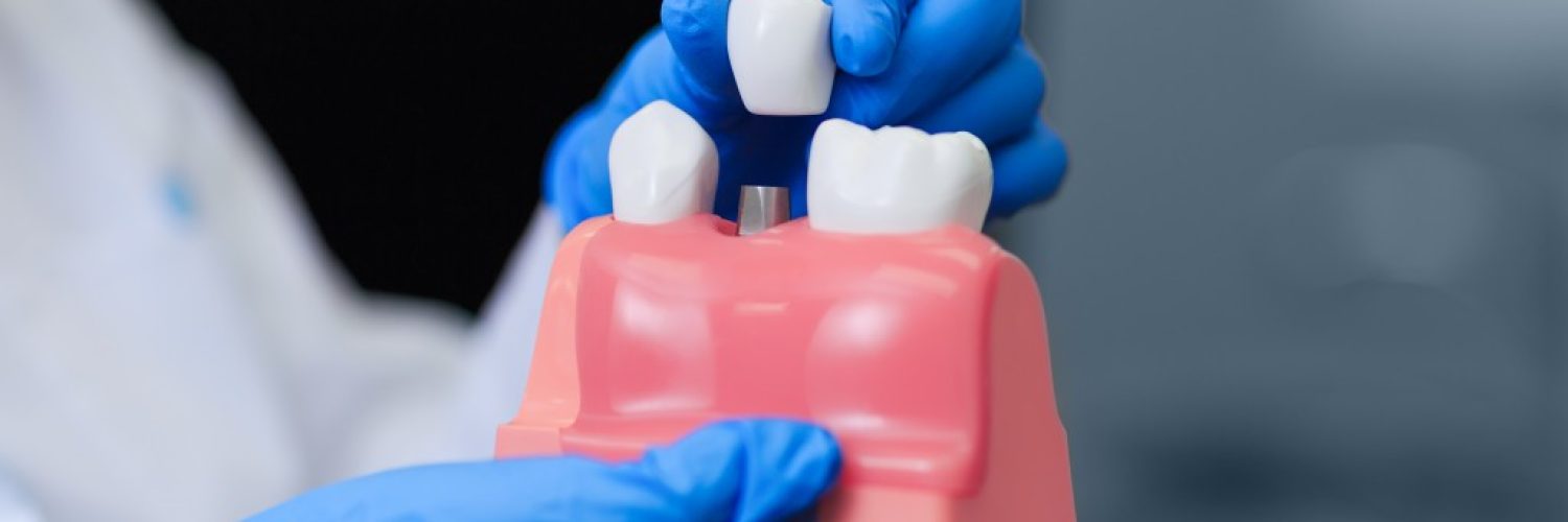 dentist holding a dental demo